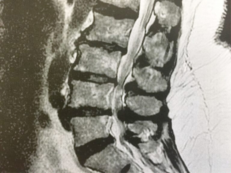 Vorsorge der OP – Bewegungsfreiheit durch abc #2