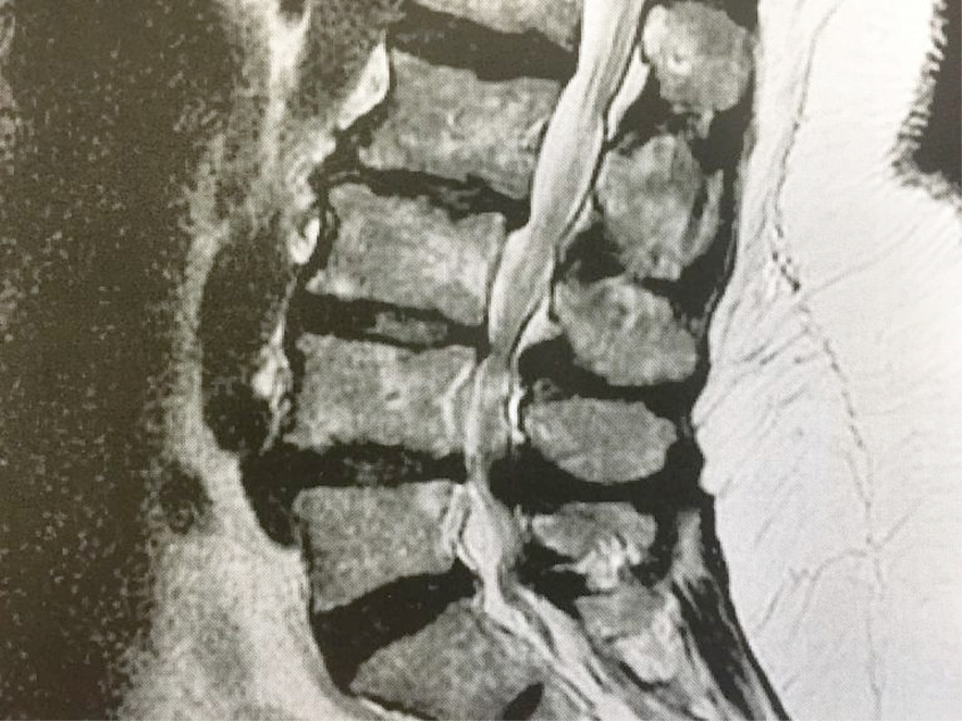 Vorsorge der OP – Bewegungsfreiheit durch abc #2